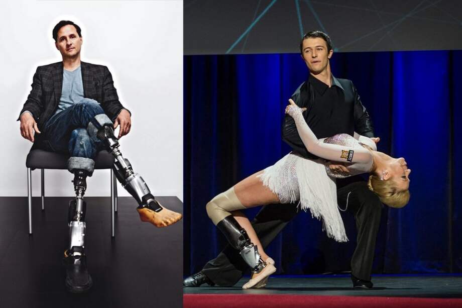 El tobillo biónico que aprendió a bailar