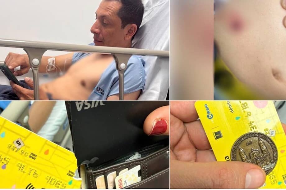 El funcionario resultó herido luego de intervenir para auxiliar a un ciclista que estaba siendo víctima de un robo en el norte de Bogotá.