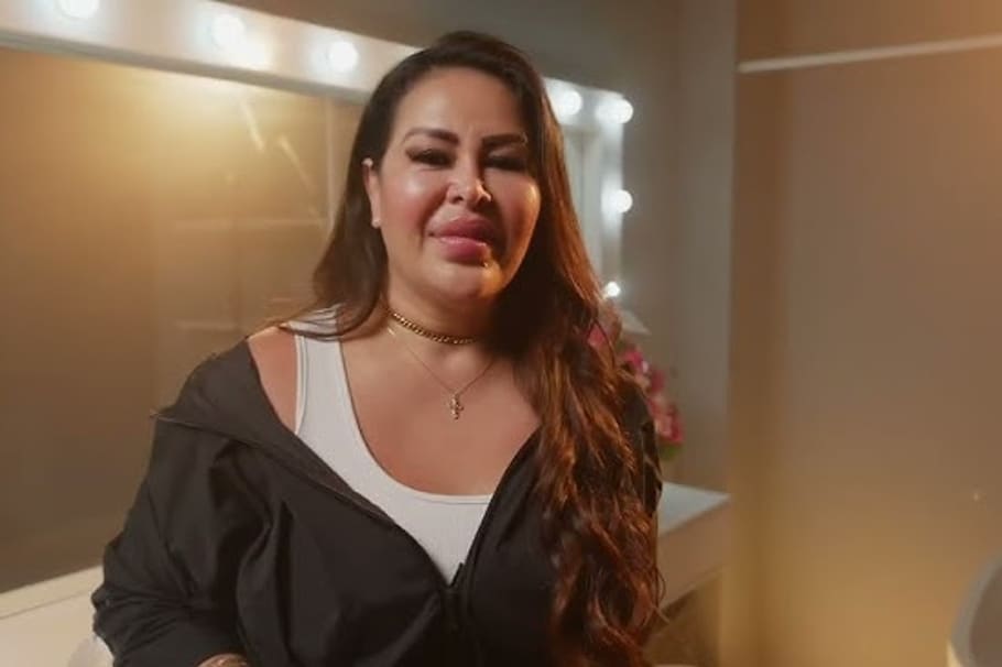 Jayna Fern, quien también fue víctima de los biopolímeros en su rostro, contó su historia en Vea. Reveló que “la gente ha sido bastante cruel”.