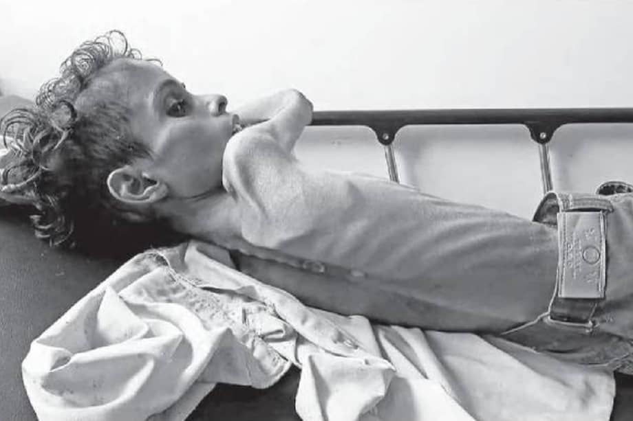 Ghazi Saleh, de 10 años, refleja la crisis alimentaria que ha generado el conflicto en Yemen. / AFP