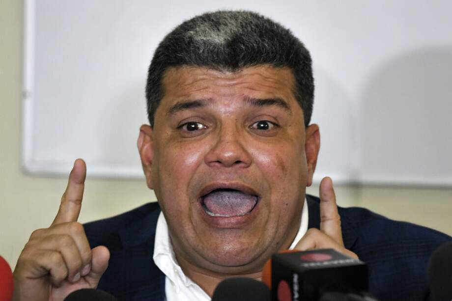 Luis Parra, diputado de Primero Justicia. / AFP