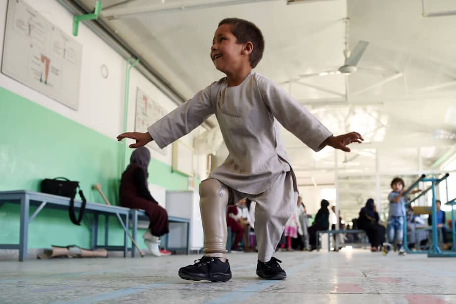 Ahmad Sayed Rahman, de cinco años, baila después de recibir una nueva prótesis en un centro médico de Afganistán. / AFP