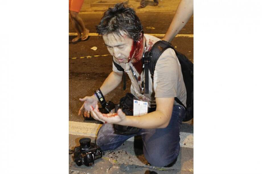 Un fotógrafo de la AFP herido por un policía en manifestación en Rio