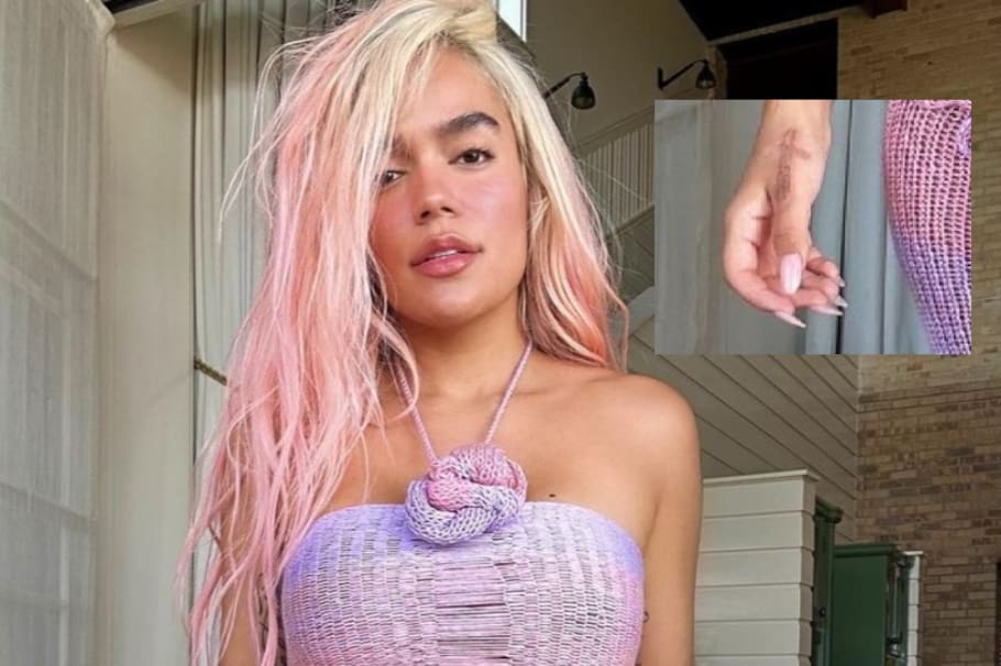 Karol G se borra el tatuaje de Anuel AA: así se ve su mano ahora