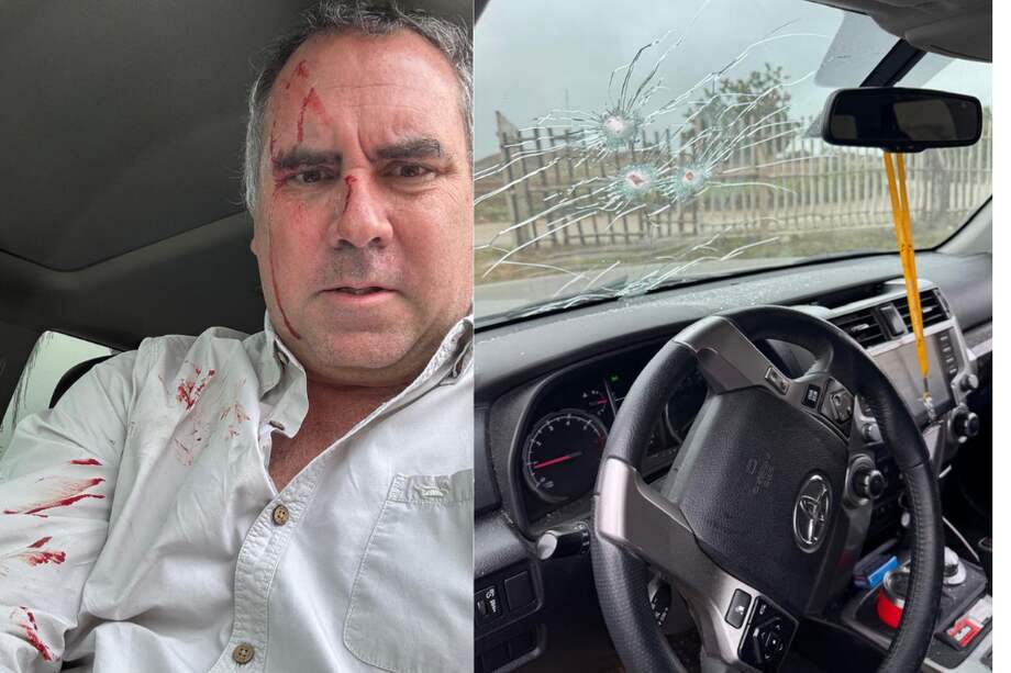 Fotografía tomada de la cuenta oficial @CostaGino de la red social X del excongresista de Perú, Gino Costa, donde se observa al candidato por la Presidencia de Perú, Rafael Belaúnde Llosa, herido después de sufrir un atentado en su contra este martes, en Lima (Perú). Belaúnde Llosa sufrió un atentado al ser atacado a disparos.