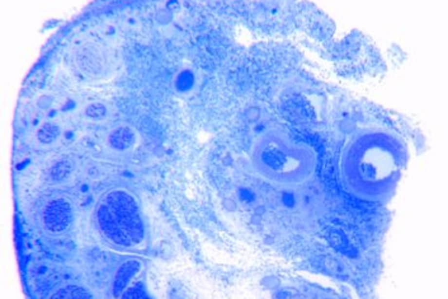 Una sección transversal ampliada del nervio dorsal del clítoris humano, que es el principal responsable de la sensación del clítoris. Cada diminuto punto azul oscuro dentro de los círculos azules más grandes representa una fibra nerviosa individual de un nervio dorsal.