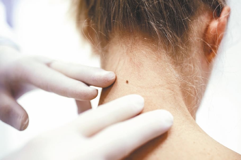 Doctor examining patient's mole on neck.