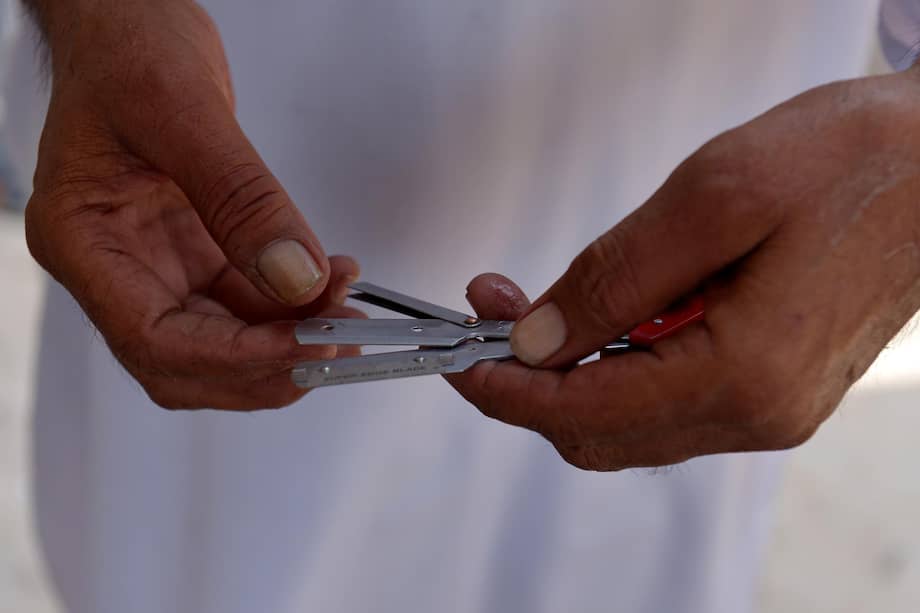 Según los médicos, la manipulación de equipos de suero intravenoso, la reutilización de jeringuillas, las transfusiones de sangre, el instrumental para perforaciones (piercings) y la reutilización de cuchillas en las barberías son las principales causas de la propagación de la hepatitis. EFE/EPA/BILAWAL ARBAB