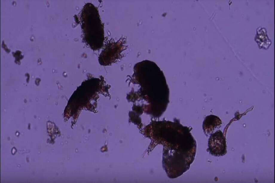 Tardígrados despertando bajo el microscopio. / Cortesía Gabriel Marín Muñoz.