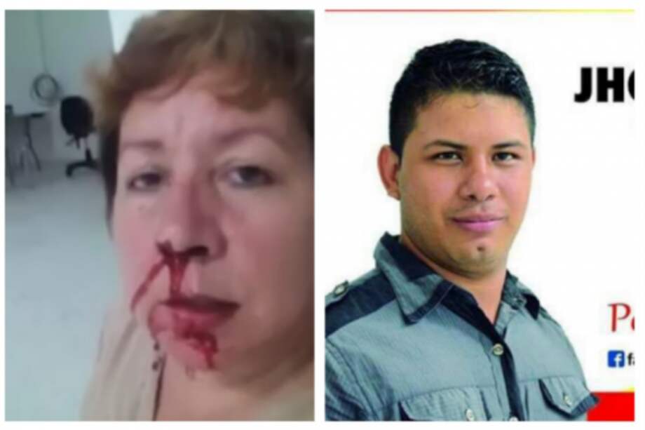 Partido de la U tomará acciones contra edil que agredió a lideresa en Cali