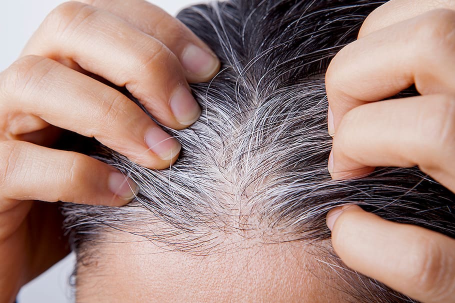 Si quieres deshacerte de las canas puedes intentar alguna de estas opciones.