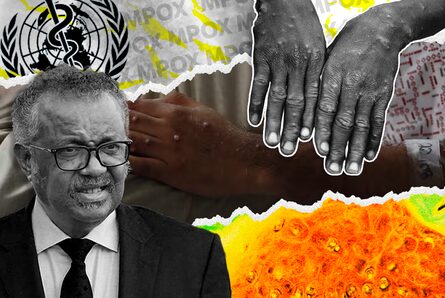 EE le explica: ¿Qué tanto avanza la mpox o viruela símica y qué podemos hacer?
