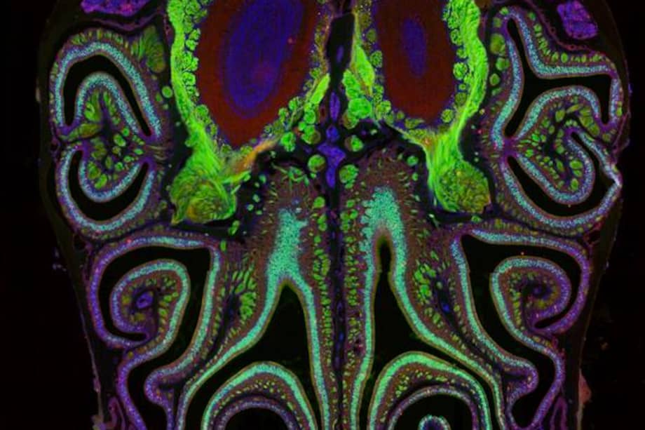 Fotografía microscópica de un corte transversal de la nariz de un ratón. El ratón fue modificado genéticamente para expresar proteína fluorescente verde en las neuronas olfativas. Un pequeño subconjunto de neuronas en proceso de muerte está marcado en rojo. /Datta