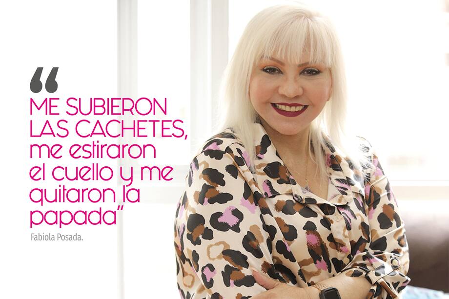 Estos fueron los cambios de 'La Gorda Fabiola' tras sus primeras operaciones estéticas.