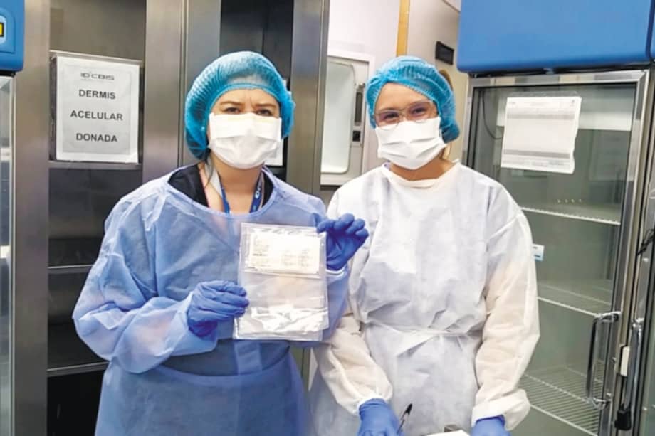 Los injertos de piel deben conservarse congelados a una temperatura de -40 grados centigrados.