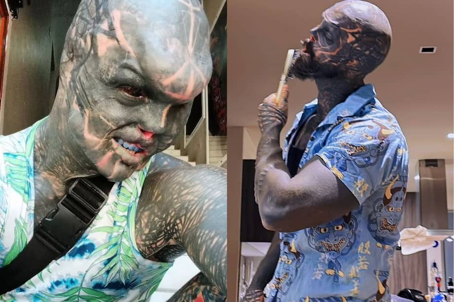 The "Black Alien Project" es definido por Anthony Loffredo como un "proyecto artístico" de modificación corporal.