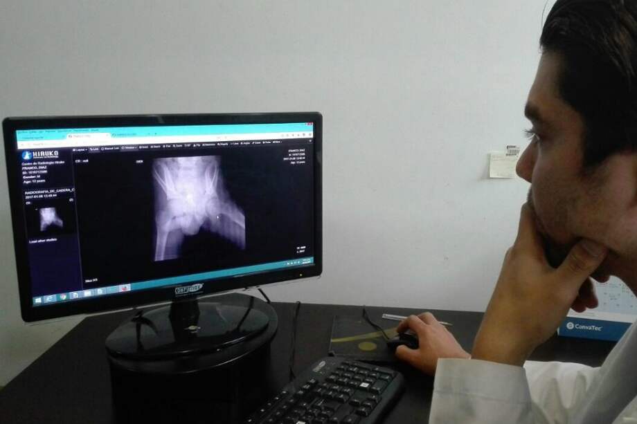 Tras 20 cirugías, salvan la vida de menor atropellado por un bus en Bogotá