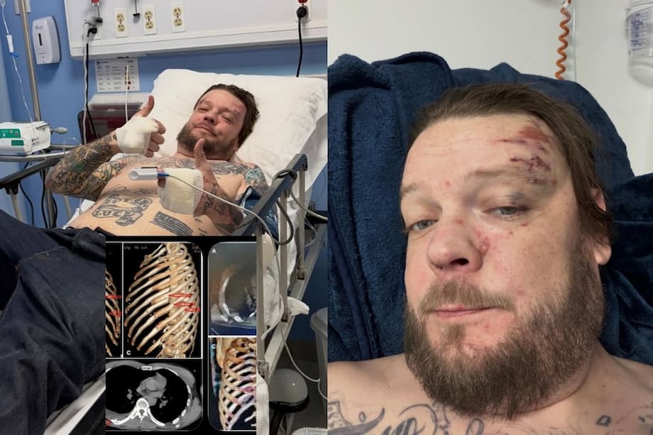 El empresario, famoso por su frase ‘No lo sé Rick, parece falso’, enfrenta un largo proceso de recuperación tras sufrir graves lesiones. ¿Qué le ocurrió?