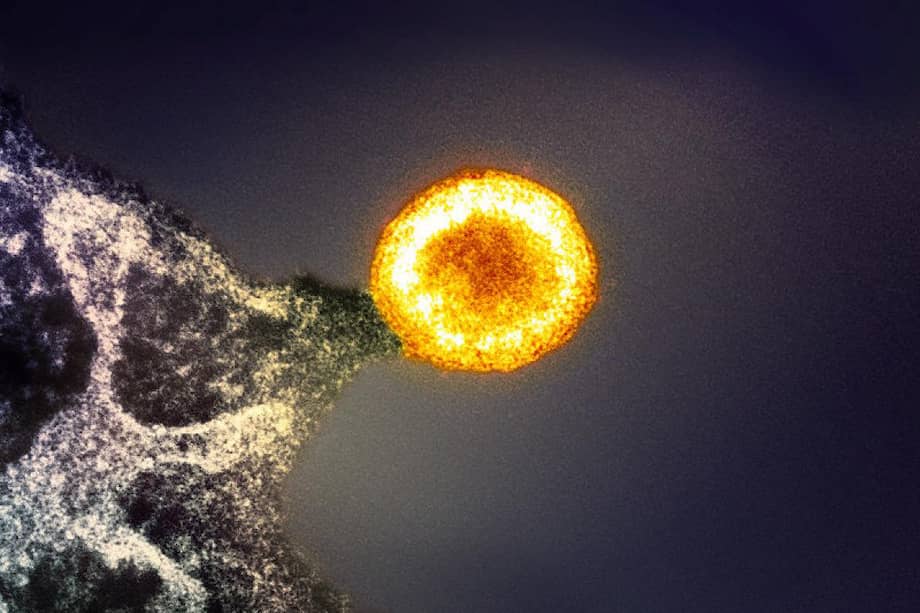 Una partícula del VIH brotando de una célula T infectada. Una sola célula T infectada por el VIH puede liberar miles de nuevas partículas víricas antes de morir.