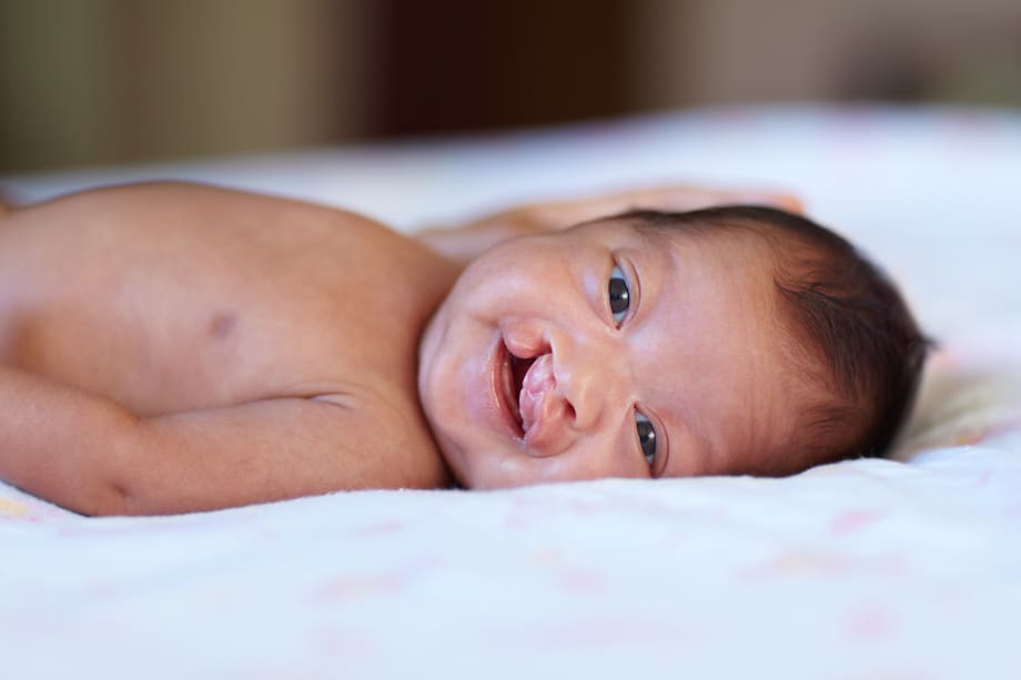 Labio leporino: 1 de cada 800 niños nace con esta afección