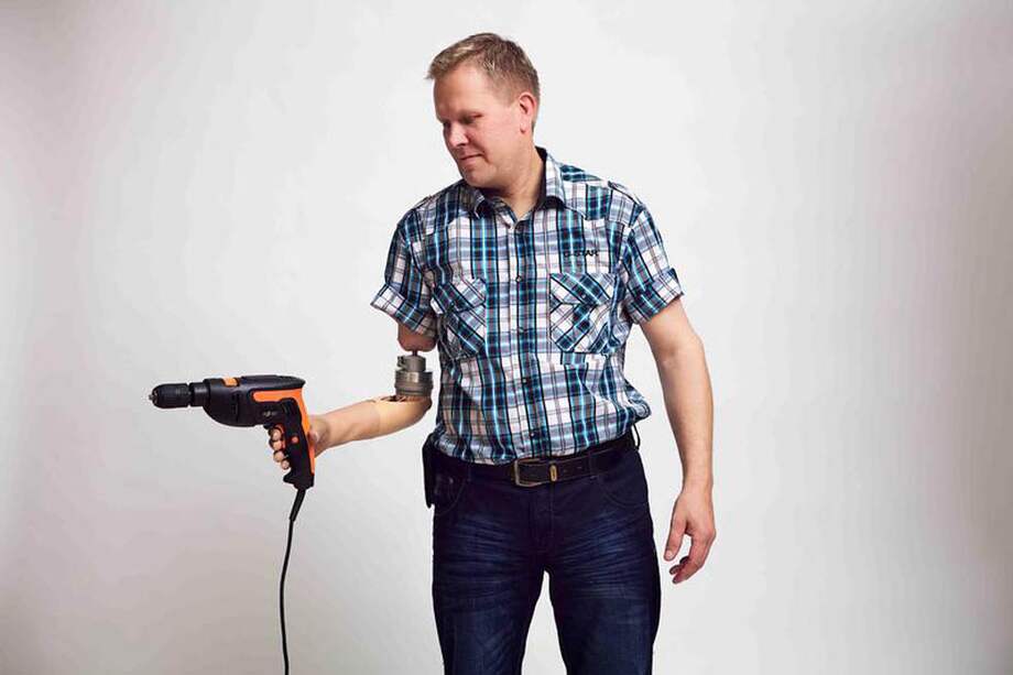 Las prótesis les han permitido a los pacientes volver a realizar actividades de la vida cotidiana. / AgenciaSinc – Ortiz-Catalan et al.