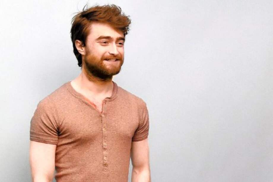 “Victor Frankestein” se estrenará en las salas de cine de Estados Unidos el próximo 25 de noviembre. / Cortesía 20th Century Fox