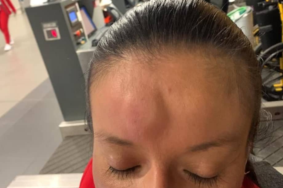 Las autoridades del Aeropuerto El Dorado capturaron a la DJ, que golpeó a la asistente de vuelo en aparente estado de embriaguez.