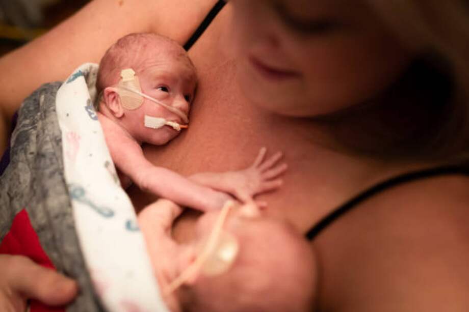 La Organización Mundial de la Salud (OMS) y el Fondo de las Naciones Unidas para la Infancia (UNICEF) recomiendan que, justo después del nacimiento, se coloque al recién nacido directamente sobre la piel desnuda de la madre. /Getty