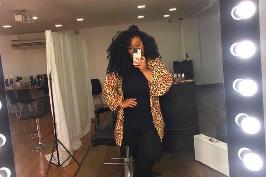 La revista de moda más famosa del mundo le apostó a una modelo con labio leporino como parte de su campaña de este mes.