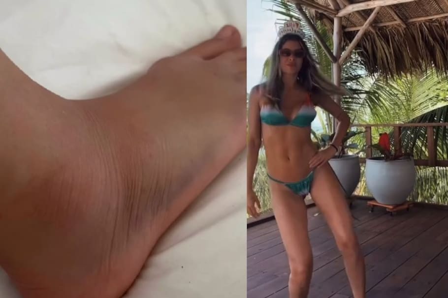 Moni Molano tuvo un accidente en plena grabación, ¿Fue grave?