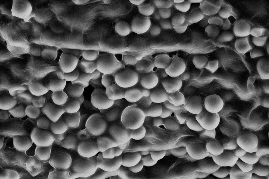 Cristales de oxalato de calcio en el chontaduro crudo, que desaparecen al cocinarlo. / Escobar & Dufour