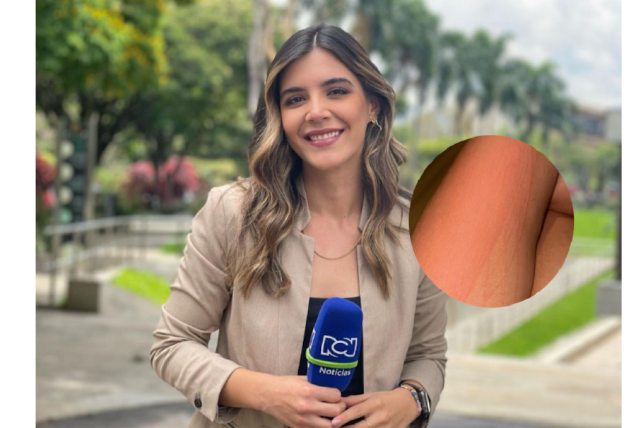 Isabella Atehortúa hizo una publicación donde reveló el terrible problema que sufre. ‘Todos estamos lidiando con algo, no te compares’.