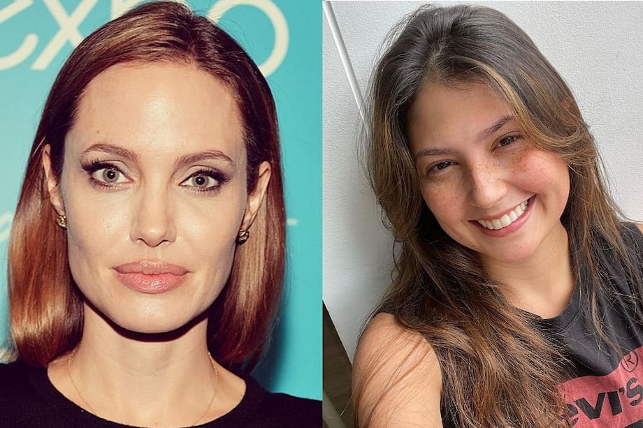 Son varios los artistas que han tenido que enfrentar dicha enfermedad. A algunos, incluso, les quedaron secuelas permanentes en su rostro.