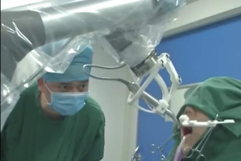Imagen del robot chino durante el procedimiento. / Youtube.