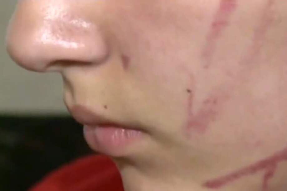 Padre e hija fueron víctimas de matoneo escolar en Bosa