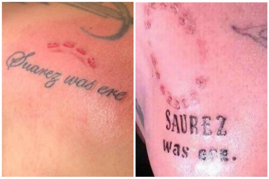 Los fallidos tatuajes de la mordida de Luis Suárez