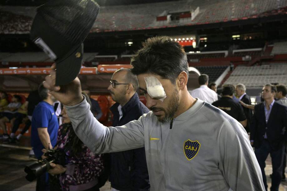 Pablo Pérez fue uno de los más afectados por los incidentes en contra del bus de Boca. / AFP