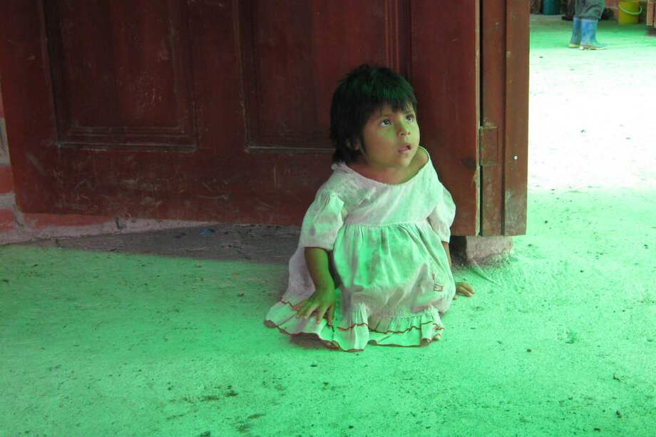 Un mayor acceso a los servicios de salud y la mejora de los servicios de saneamiento y de las viviendas contribuiría a reducir el riesgo de infección. / Archivo