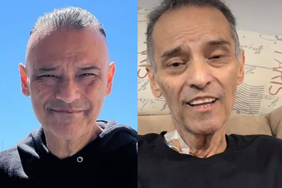 Xava había revelado la agresividad del cáncer que padecía. A la izquierda como lucía hace un año y a la derecha, hace 15 días.