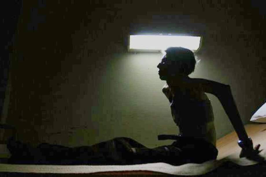 Hombres con anorexia, un debate oculto