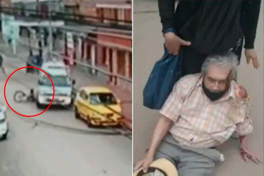 El hombre presentó heridas en el rostro y la columna.