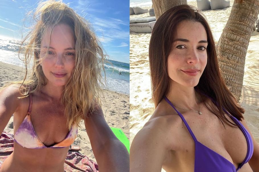 Estas celebridades decidieron, después de años, regresar a la naturalidad y explantar sus prótesis.