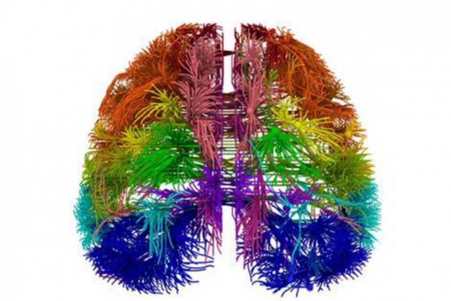 IBM desarrolla un microchip que simula el funcionamiento del cerebro humano