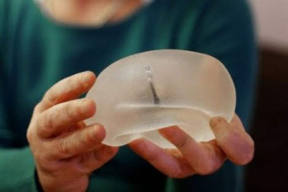 'Chocolatada' en Cali para ayudar a mujer con implantes PIP