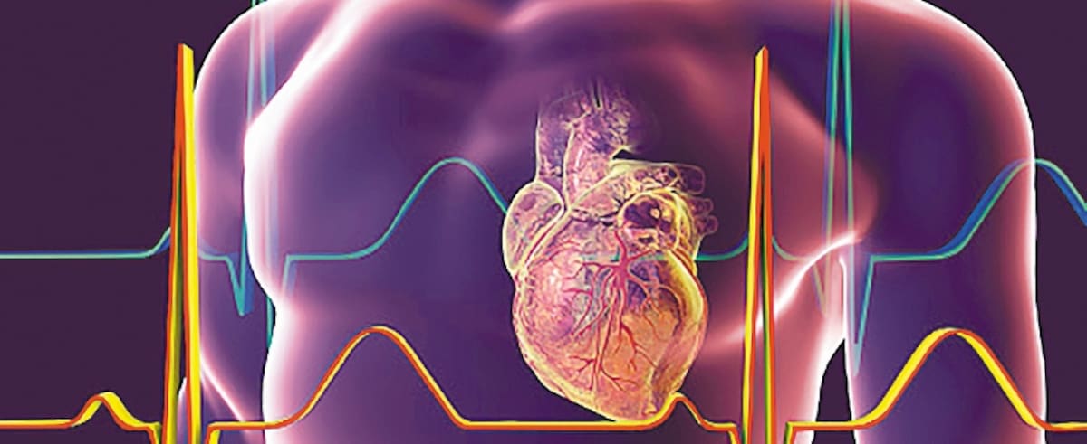 Heart with coronary vessels inside human body, computer illustration.