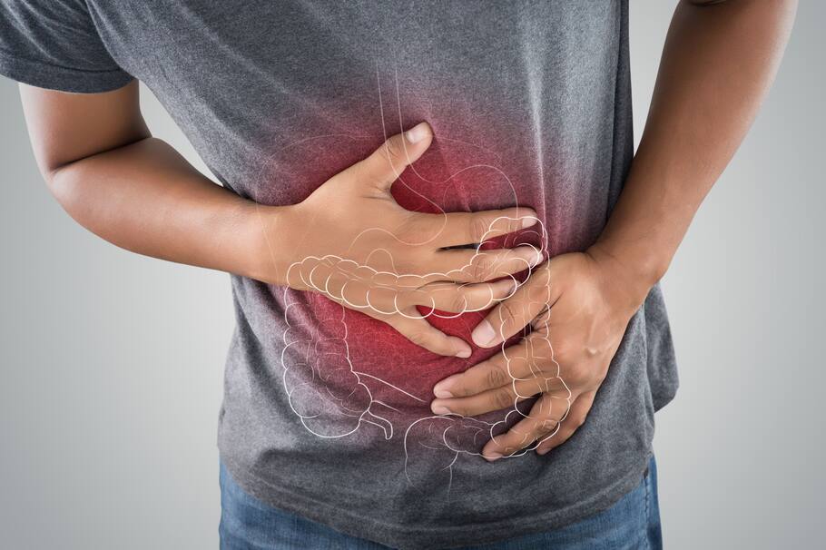 ¿Cómo controlar el síndrome del colon irritable?