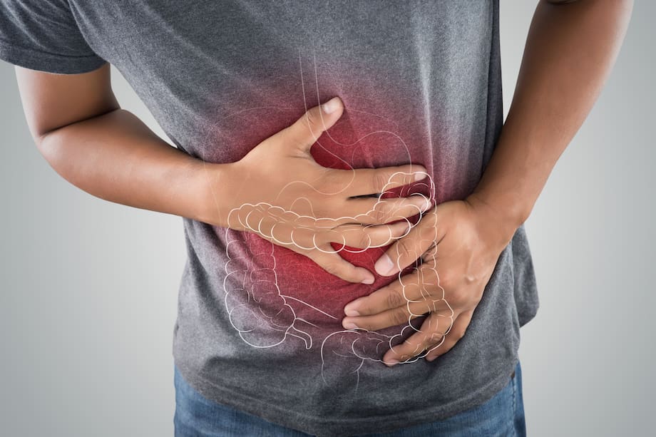 El síndrome del colon irritable afecta al intestino grueso y, a veces, también al intestino delgado. / Foto: cortesía.