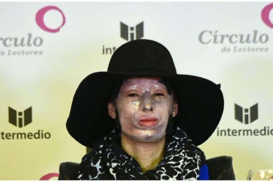 Congreso aprobó ley 'Natalia Ponce' que eleva penas a ataques con ácidos