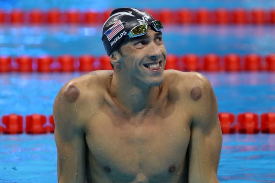 'Cupping', la terapia detrás de los moretones de Michael Phelps en la espalda
