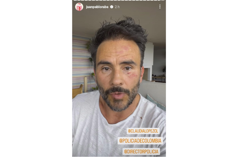 Juan Pablo Raba etiquetó a varias autoridades para denunciar su caso